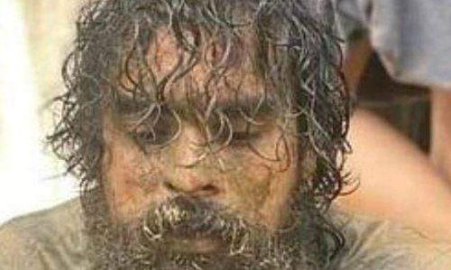 ടൊവിനോക്ക്​ ഇടിയേറ്റത്​ വയറ്റിൽ; ആന്തരിക രക്​തസ്രാവം അറിഞ്ഞില്ല