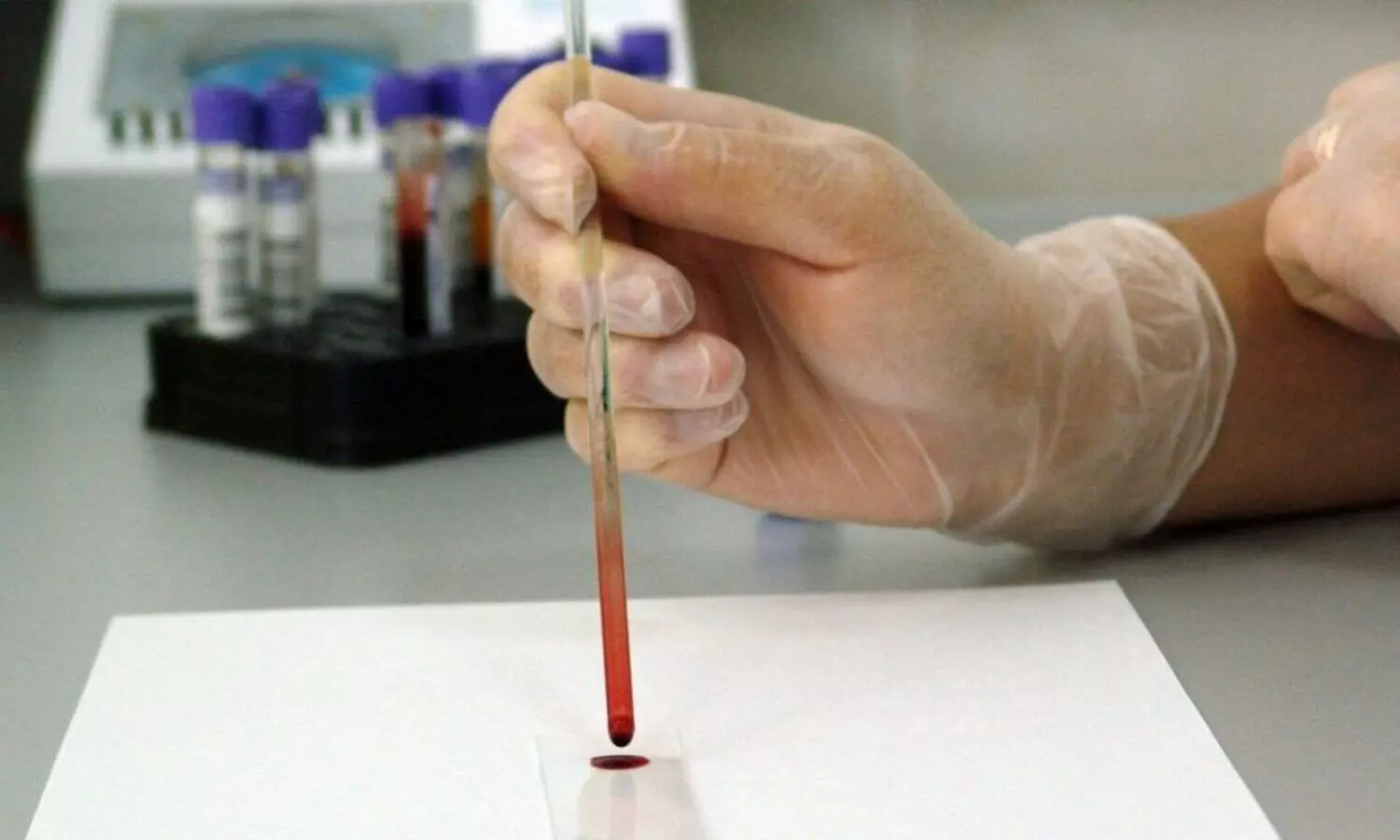 കോവിഡ്​: ആയുഷി​െൻറ ചികിത്സാരീതി അശാസ്​ത്രീയമെന്ന്​  ഐ.എം.എ; മറുപടിയുമായി ​ശാസ്​ത്രജ്ഞർ