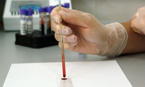 കോവിഡ്​: ആയുഷി​െൻറ ചികിത്സാരീതി അശാസ്​ത്രീയമെന്ന്​  ഐ.എം.എ; മറുപടിയുമായി ​ശാസ്​ത്രജ്ഞർ