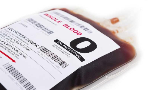 ഒ രക്തഗ്രൂപ്പിലുള്ളവർക്ക്​ കോവിഡ്​ സാധ്യത കുറവെന്ന്​ പഠനം