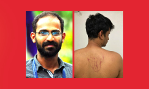 അഴിമുഖത്ത്​ ​ഒറ്റപ്പെടുന്ന മാധ്യമപ്രവർത്തകർ