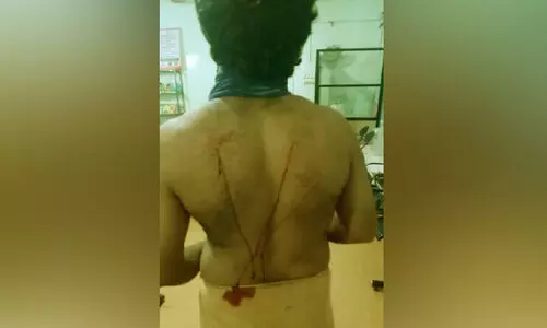 കോ​ണ്‍ഗ്ര​സ് പ്ര​വ​ര്‍ത്ത​ക​െൻറ മുതുകിൽ കത്തികൊണ്ട്​ വരഞ്ഞ്​ ബി.ജെ.പി ആ​ക്ര​മ​ണം