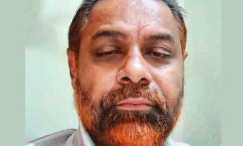 കോവിഡ്: മലപ്പുറം സ്വദേശി ജിദ്ദയിൽ മരിച്ചു