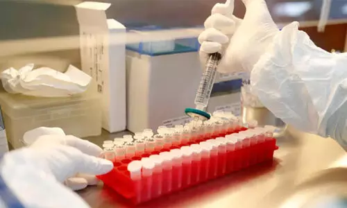 രാസ പരിശോധന ലാബുകളുടെ കുറവ്​; തൊണ്ടിമുതലുകൾ ​െകട്ടിക്കിടക്കുന്നു