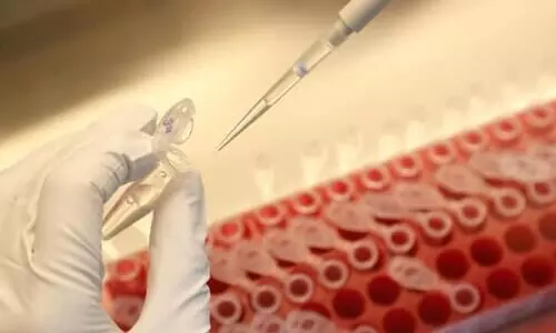 2020ൽ തന്നെ കോവിഡ്​ വാക്​സിൻ നൽകാനാകുമെന്ന്​ ഫിസർ