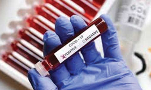 814 പേർക്കുകൂടി കോവിഡ്​; 807 പേർക്ക്​ രോഗമുക്തി