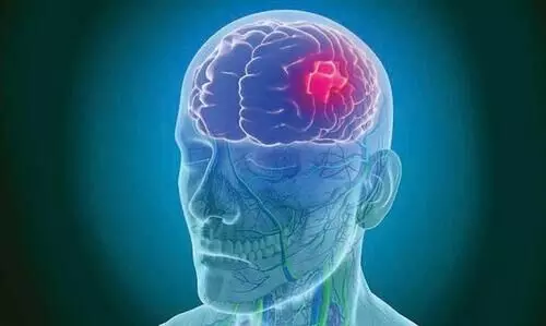 october 29, world stroke day , kk shailaja facebokk post