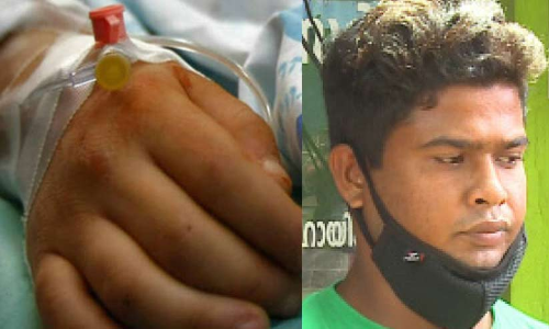 പിതൃസഹോദരന്‍റെ ക്രൂരമർദനം; അഞ്ചുവയസ്സുകാരന്‍റെ തലയോട്ടി പൊട്ടി