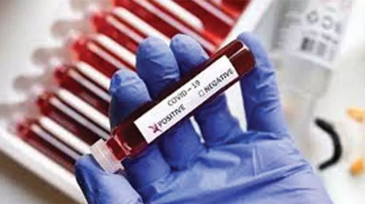 671 പേർക്ക്​ കൂടി കോവിഡ്​; 727 പേർക്ക്​ രോഗമുക്തി