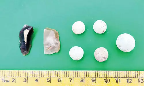 ഫറോക്ക്​ ടിപ്പുകോട്ടയിൽ നിന്ന്  വെടിയുണ്ടകളും തീക്കല്ലുകളും കണ്ടെത്തി