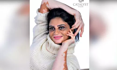 തൊലിയിലും നിറത്തിലുമെന്തുണ്ട്? പ്രചോദനമായി മഞ്ജുവി​െൻറ മോഡലിങ്