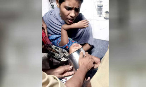 രണ്ടുവയസ്സുകാര​െൻറ തലയില്‍ പാത്രം കുടുങ്ങി; അഗ്നിശമനസേന രക്ഷകരായി