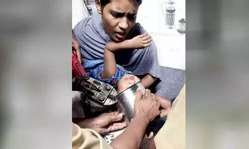 രണ്ടുവയസ്സുകാര​െൻറ തലയില്‍ പാത്രം കുടുങ്ങി; അഗ്നിശമനസേന രക്ഷകരായി