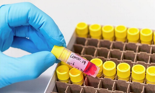 ഇന്ന് 6010 പേര്‍ക്ക് കോവിഡ്; 6698 പേർക്ക്​ രോഗമുക്​തി