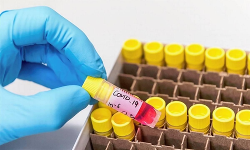 സംസ്ഥാനത്ത് ഇന്ന് 5440 പേര്‍ക്ക് കോവിഡ്; 24 മരണങ്ങൾ