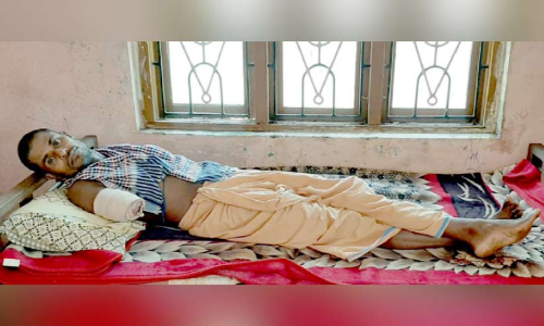 ജോലിക്കിടെ പരിക്കേറ്റ്​ കൈ നഷ്​ടപ്പെട്ട ബധിര യുവാവ് സഹായം തേടുന്നു