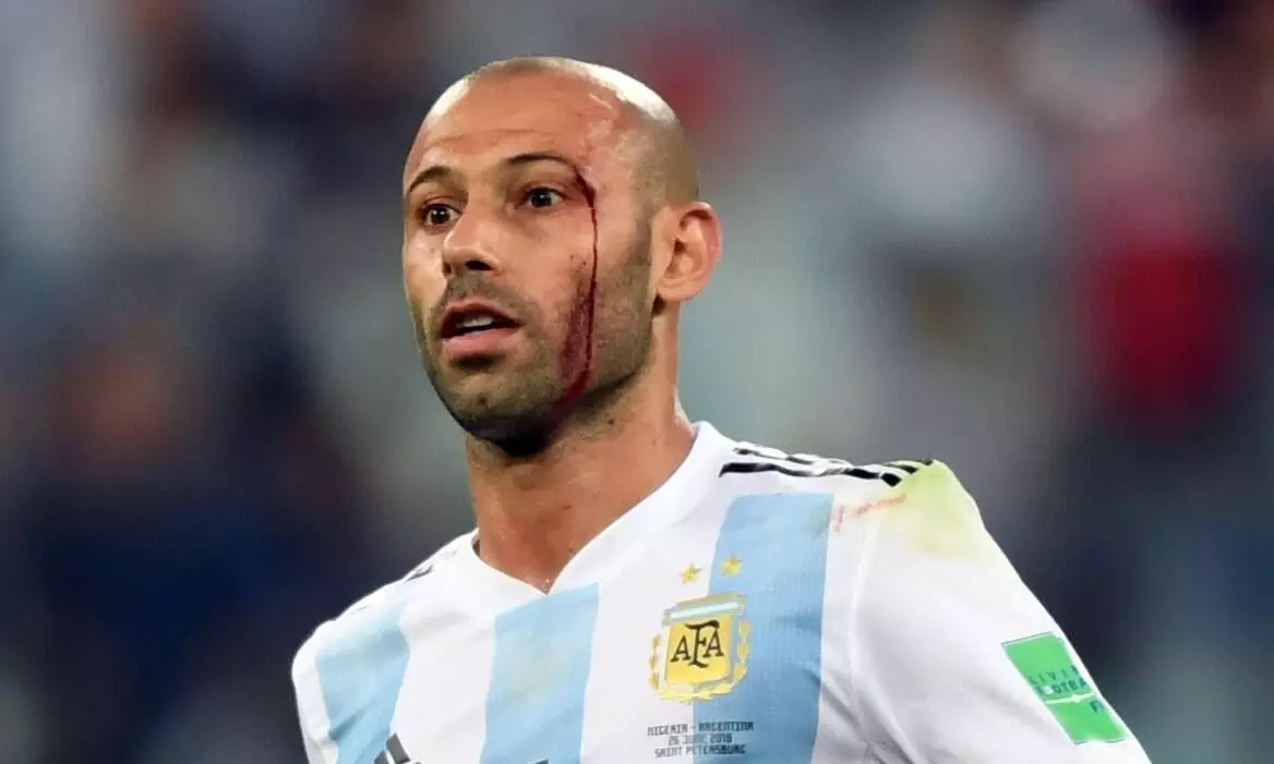 മഷറാനോ: അതിജീവനങ്ങളുടെ പാഠപുസ്തകം മഷറാനോ: അതിജീവനങ്ങളുടെ പാഠപുസ്തകം