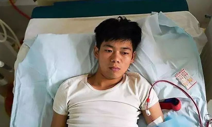 കിഡ്​നി വിറ്റിട്ടാണേലും​ ഐഫോൺ വാങ്ങണം എന്ന്​ പറയുന്നവർ അറിയണം ഈ ചൈനീസ്​ യുവാവിൻെറ കഥ