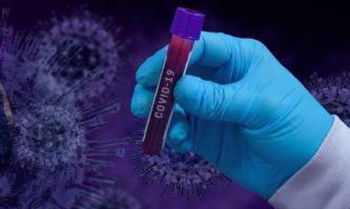 കോവിഡ്​: സൗദിയിൽ വീണ്ടും മരണനിരക്ക്​ കുറഞ്ഞു