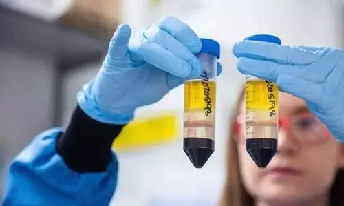 കോവിഡ് വാക്സിൻ വാങ്ങിക്കൂട്ടി ബ്രിട്ടൻ കോവിഡ് വാക്സിൻ വാങ്ങിക്കൂട്ടി ബ്രിട്ടൻ