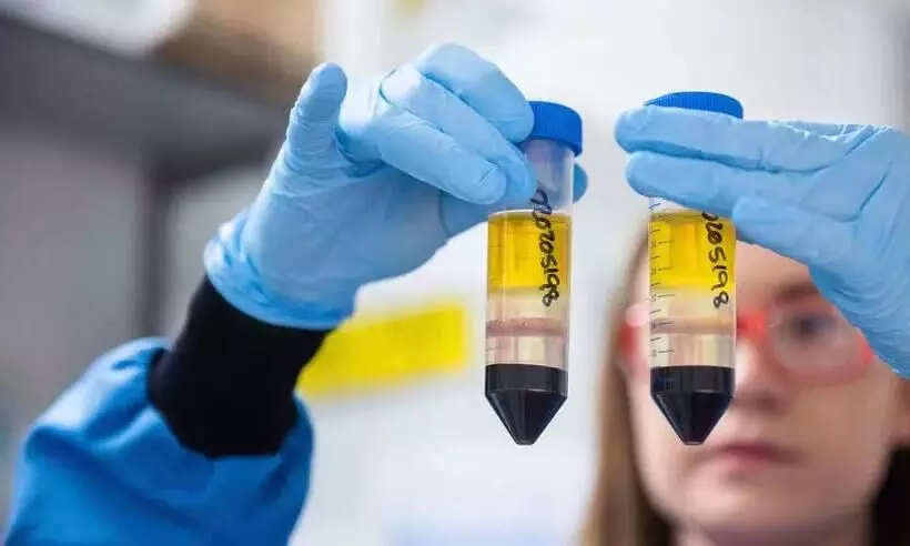 കോവിഡ് വാക്സിൻ വാങ്ങിക്കൂട്ടി ബ്രിട്ടൻ കോവിഡ് വാക്സിൻ വാങ്ങിക്കൂട്ടി ബ്രിട്ടൻ