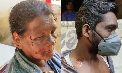 മുക്കത്ത് ഭീതിപരത്തി ചെന്നായ്; നാല് പേർക്ക് കടിയേറ്റു