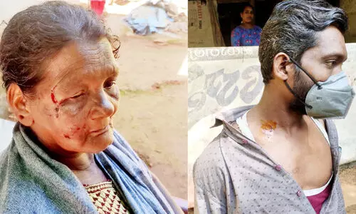 ചെന്നായ നാട്ടിലിറങ്ങി, നാലുപേർക്ക് കടിയേറ്റു