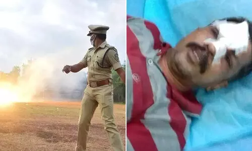 പരിശീലനത്തിനിടെ ഗ്രനേഡ്​ പൊട്ടിത്തെറിച്ചു;  പൊലീസുകാരനു​ൾപ്പെടെ രണ്ടുപേർക്ക്​ പരിക്ക്