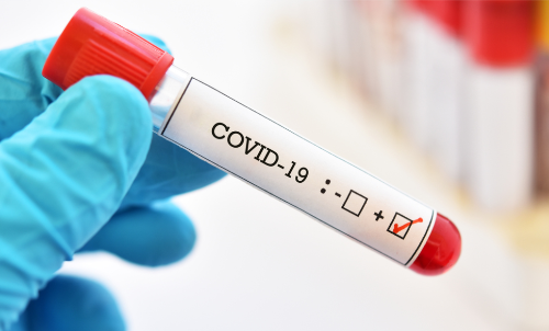 പോസിറ്റീവും നെഗറ്റീവും; കോവിഡ് ടെസ്റ്റിൽ പുലിവാൽ​ പിടിച്ച്​ പ്രവാസി, പുറത്തിറങ്ങിയാൽ വീട് സീൽ ചെയ്യുമെന്ന്​ ആരോഗ്യ വകുപ്പ്​