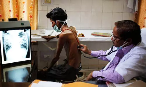 കോ​വി​ഡ്​ കാ​ല​ത്ത്​ ക്ഷ​യ​രോ​ഗി​ക​ളു​ടെ എ​ണ്ണ​ത്തി​ൽ നേ​രി​യ വ​ർ​ധ​ന