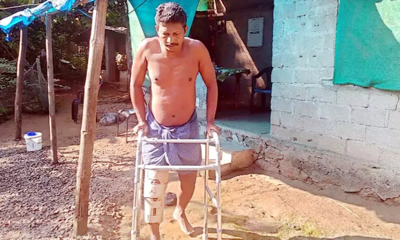 കാട്ടാനയുടെ ചവിട്ടേറ്റ ആദിവാസി യുവാവിനെ തിരിഞ്ഞുനോക്കാതെ വനംവകുപ്പ് കാട്ടാനയുടെ ചവിട്ടേറ്റ ആദിവാസി യുവാവിനെ തിരിഞ്ഞുനോക്കാതെ വനംവകുപ്പ്