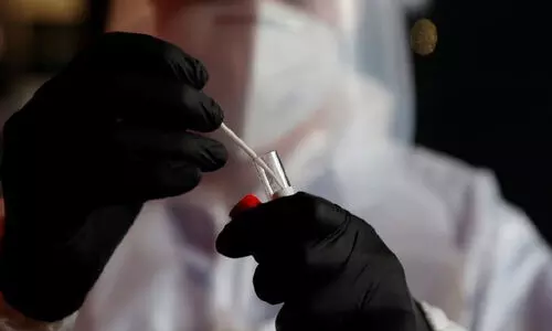 കൊറോണ വൈറസ് വകഭേദം ഫ്രാൻസിലും ലബനാനിലും കൊറോണ വൈറസ് വകഭേദം ഫ്രാൻസിലും ലബനാനിലും