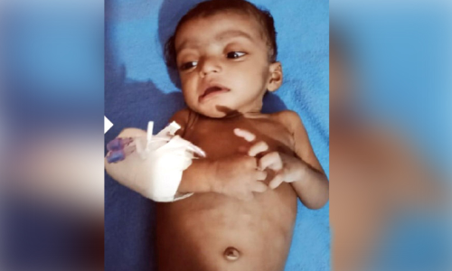 ഏ​ഴു മാ​സം പ്രാ​യ​മാ​യ ഹാ​ർ​ദ​വി​െൻറ ശ​സ്ത്ര​ക്രി​യ​ക്ക് വേ​ണ്ട​ത് 40 ല​ക്ഷം; കാരുണ്യം തേടി നിർധന കുടുംബം