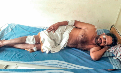 സി.പി.ഐ ലോക്കൽ സെക്രട്ടറിയെ കാറിടിച്ച് അപായപ്പെടുത്താൻ ശ്രമം