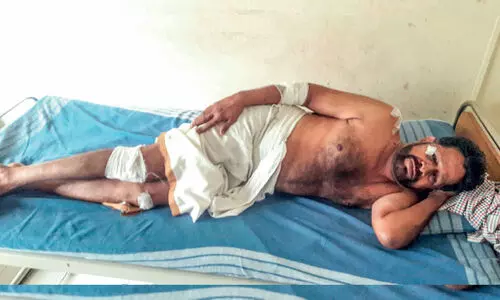 സി.പി.ഐ ലോക്കൽ സെക്രട്ടറിയെ കാറിടിച്ച് അപായപ്പെടുത്താൻ ശ്രമം