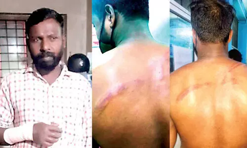 പുതുവത്സരാഘോഷത്തിനിടെ സംഘർഷം; പൊലീസുകാരനുൾെപ്പടെ അഞ്ചുപേർക്ക് പരിക്ക് പുതുവത്സരാഘോഷത്തിനിടെ സംഘർഷം; പൊലീസുകാരനുൾെപ്പടെ അഞ്ചുപേർക്ക് പരിക്ക്