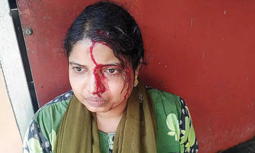 അ​തി​രു​ത​ര്‍ക്കം:  സിമൻറ്​ കട്ടക്ക് ഏറ്; ദമ്പതികള്‍ക്ക് പരിക്ക്