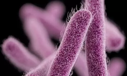 shigella Bacteria Representative Image
