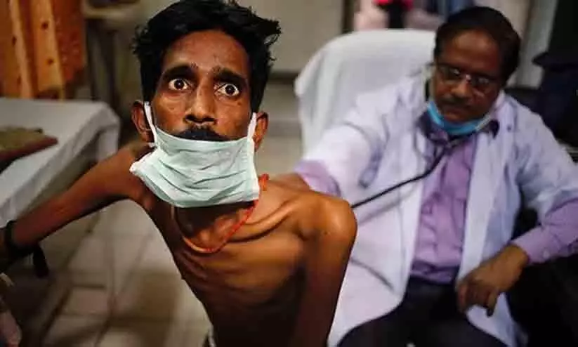 Tuberculosis in India: TB still a bigger killer than Covid in India