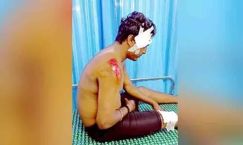 Biker injured by pig