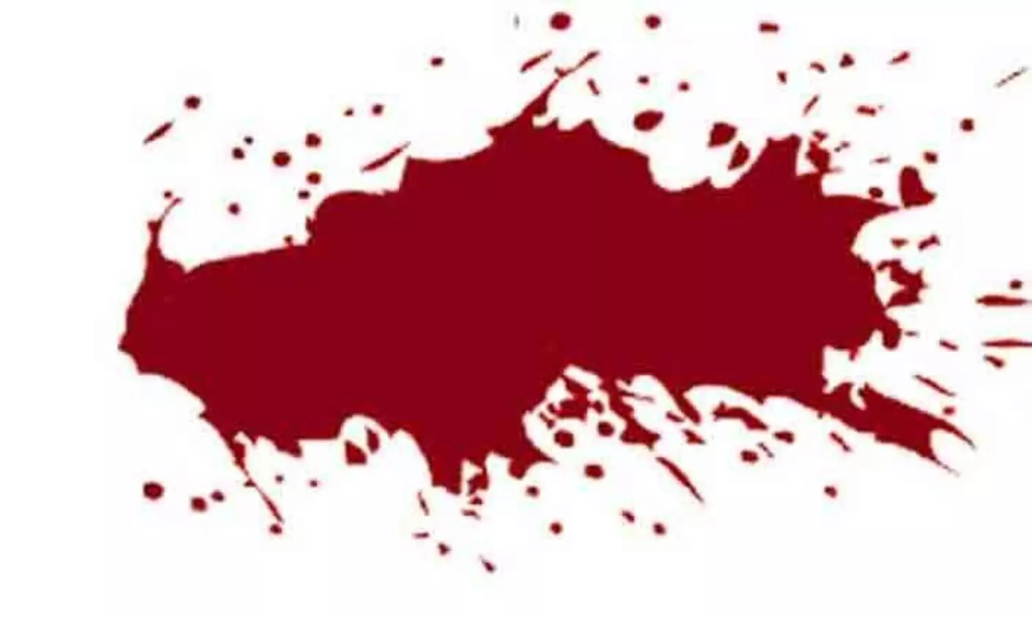 The young woman was injured in the attack elephant