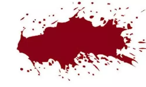 The young woman was injured in the attack elephant