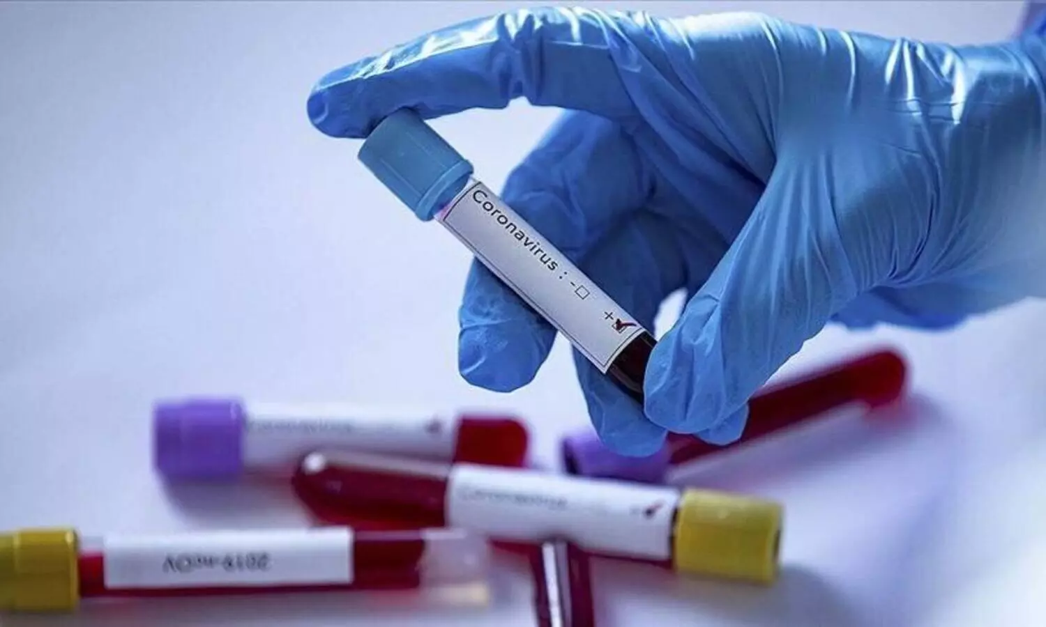 സൗദിയിൽ കോവിഡ് മരണം പത്ത്​ മാസത്തെ കുറഞ്ഞ നിരക്കിൽ