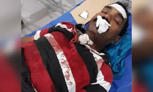 ഓട്ടോക്ക് സൈഡ് കൊടുത്തില്ലെന്നാരോപിച്ച് കാർ ഡ്രൈവറെ അടിച്ച് പല്ല് കൊഴിച്ചു ഓട്ടോക്ക് സൈഡ് കൊടുത്തില്ലെന്നാരോപിച്ച് കാർ ഡ്രൈവറെ അടിച്ച് പല്ല് കൊഴിച്ചു