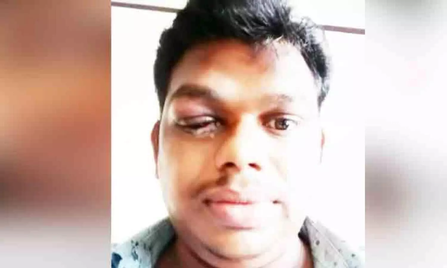 Home invasion; The young man was injured