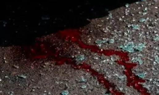 ട്രെയിനിടിച്ച് റെയിൽവെ ജീവനക്കാരിയുടെ കാൽ മുറിച്ചുമാറ്റി ട്രെയിനിടിച്ച് റെയിൽവെ ജീവനക്കാരിയുടെ കാൽ മുറിച്ചുമാറ്റി