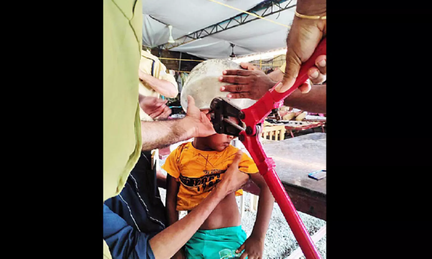 കു​ട്ടി​യു​ടെ ത​ല ക​ല​ത്തി​ല്‍ കു​ടു​ങ്ങി; ഫ​യ​ര്‍ഫോ​ഴ്‌​സ് ര​ക്ഷ​പ്പെ​ടു​ത്തി