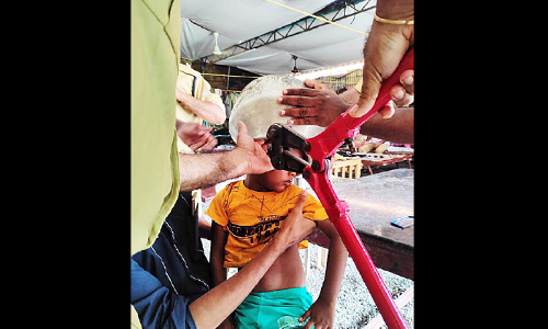 കു​ട്ടി​യു​ടെ ത​ല ക​ല​ത്തി​ല്‍ കു​ടു​ങ്ങി; ഫ​യ​ര്‍ഫോ​ഴ്‌​സ് ര​ക്ഷ​പ്പെ​ടു​ത്തി