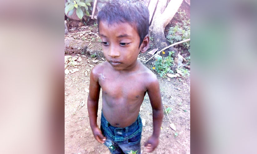 മുള്ളുമലയിൽ തെരുവുനായ് ശല്യം രൂക്ഷം മുള്ളുമലയിൽ തെരുവുനായ് ശല്യം രൂക്ഷം