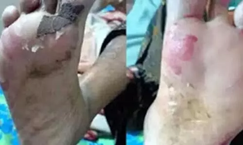 Glue spilled in footwear